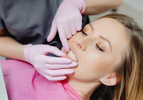 Top Vibe Beauty Teeth Whitening