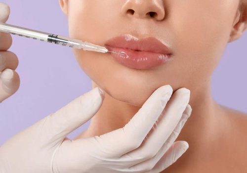 top vibe beauty fillers